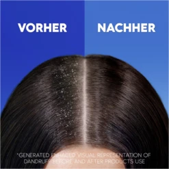 Haarshampoo Anti-Schuppen Citrus Fresh -Berühmt Kosmetikladen MAM 10411338 SHOP IMAGE 1.4